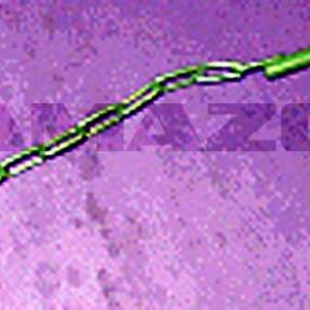 Absteckbolzen (02) (911043) Amazone